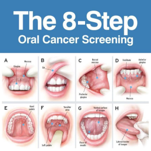 Oral Cancer Diagnosis, Symptoms & Treatments