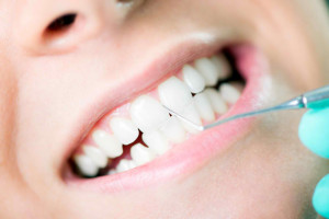 dental-health-benefits-of-professional-dental-cleanings