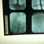 dentist xray