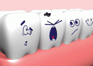 Individuals with Most Decayed Tooth