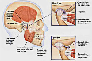 Several Factors that Highly Cause TMJ