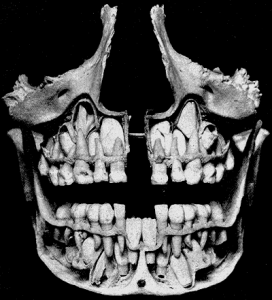 Primary Facts of Primary Teeth