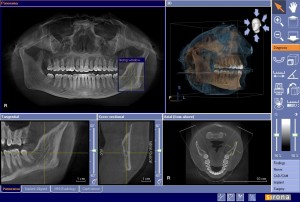 perks-of-galileos-3-d-imaging-system