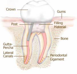 tidbits-of-molar-root-canal