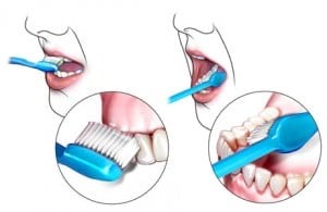 poor-oral-hygiene-effects-to-children2